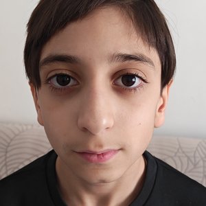 MIRAÇ AYAZ ÖZER